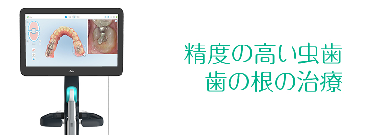 精度の高い虫歯・歯の根の治療