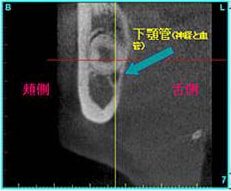 口腔外科