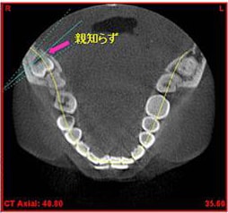 口腔外科