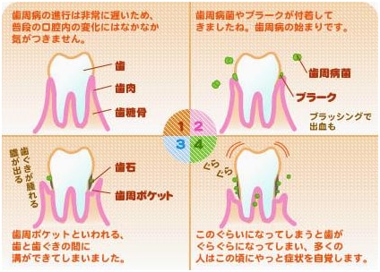 歯周歯科